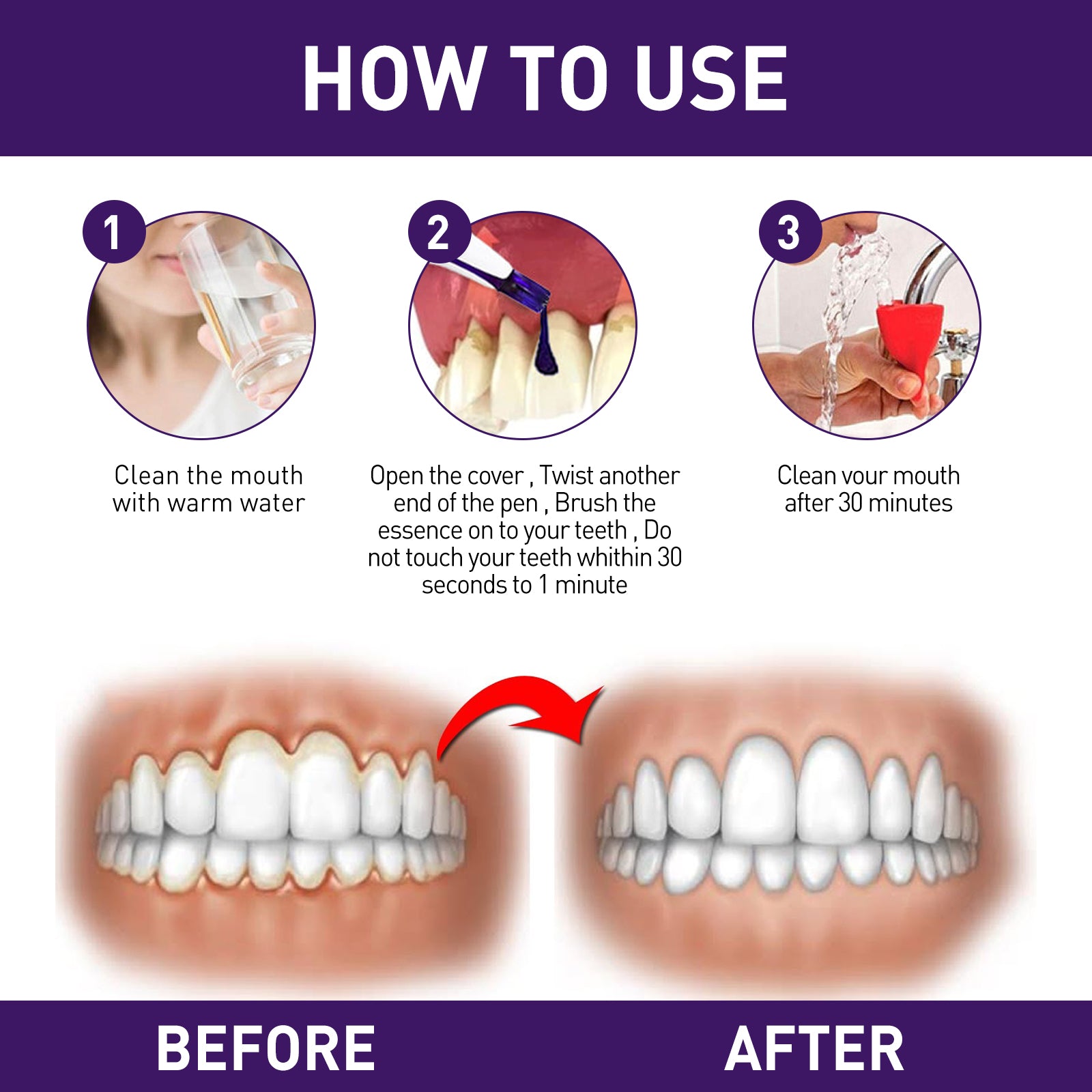 Gum Corrector Pen, Teeth Cleaning Whitening Brightening Repair Gum Teeth Beauty Pen