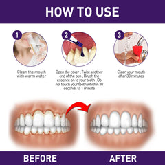 Gum Corrector Pen, Teeth Cleaning Whitening Brightening Repair Gum Teeth Beauty Pen