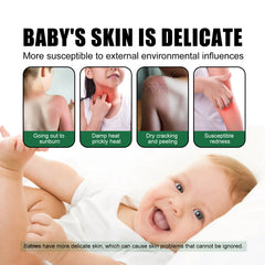 Baby Ultraviolet Rays & Outdoor Sun-Proof Spray, Protect The Skin From Strong Sun And Protect The Baby's Outdoor Activities